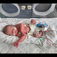 Chelsea joined the competition — help win amazing prizes! newborn, baby, incubator, hospital, medical_equipment, monitoring, nasal_tube, blanket, sleeping, infant, premature, healthcare, wired, care, medical, patient, fragile, tubes, intensive_care, clinic