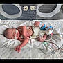 newborn, baby, incubator, hospital, medical_equipment, monitoring, nasal_tube, blanket, sleeping, infant, premature, healthcare, wired, care, medical, patient, fragile, tubes, intensive_care, clinic