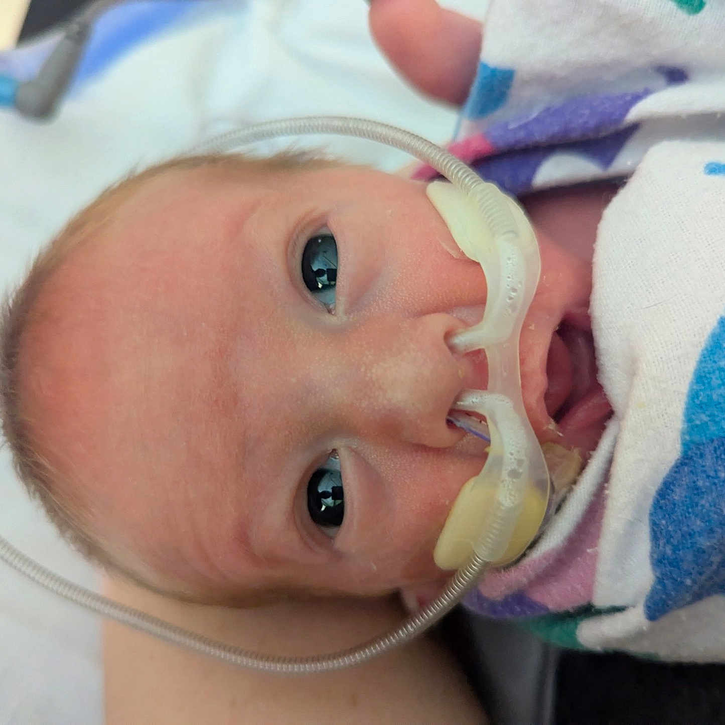 Henry joined the competition — help win amazing prizes! newborn, baby, infant, face, oxygen_tubes, medical, hospital, blanket, close_up, person, portrait, eyes, skin, head, healthcare, child, care, cute, wrapped, bed