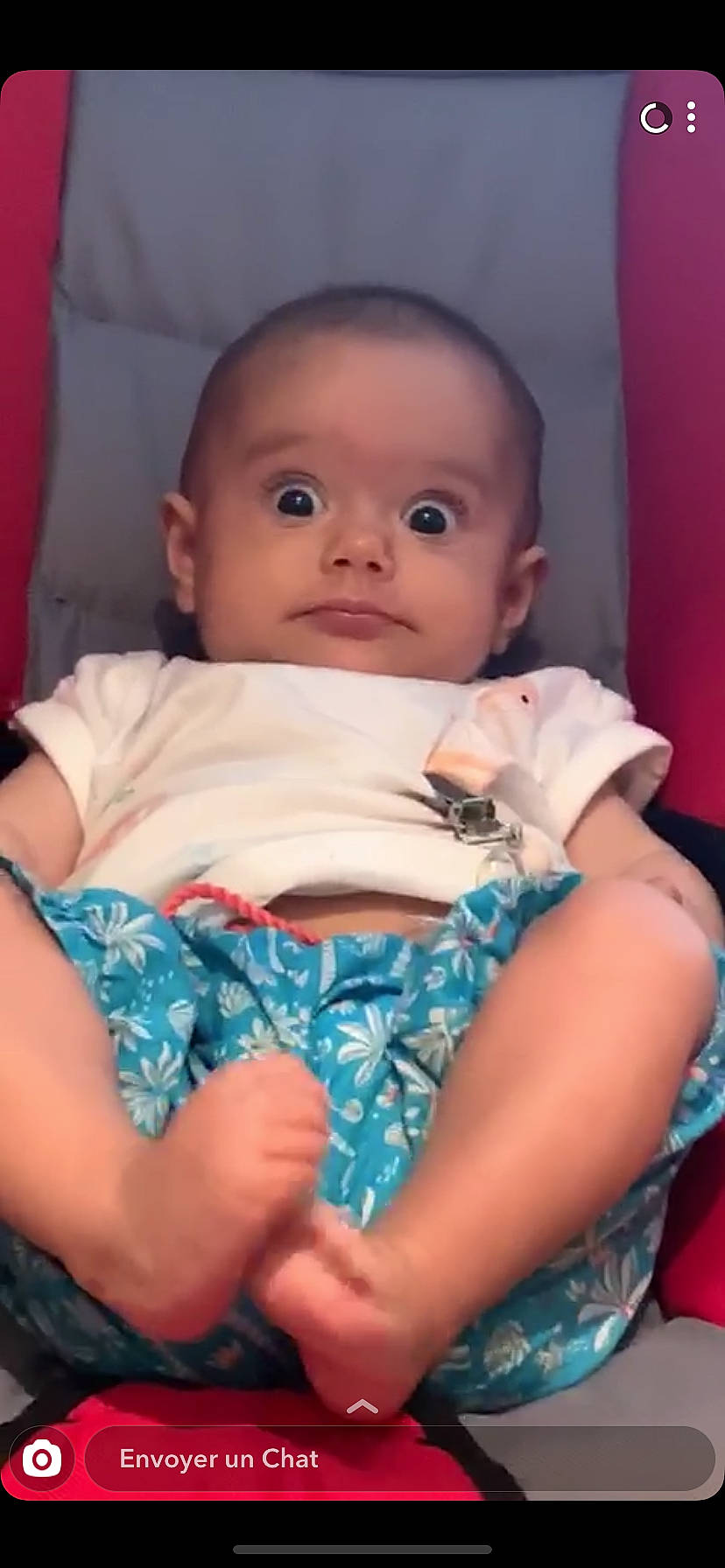 Myla participe au concours pour gagner de l'argent avec cette photo : baby, baby_products, cheek, child, chin, eye, face, finger, forehead, head, human, iris, lip, mouth, nose, person, product, sitting, skin, thumb