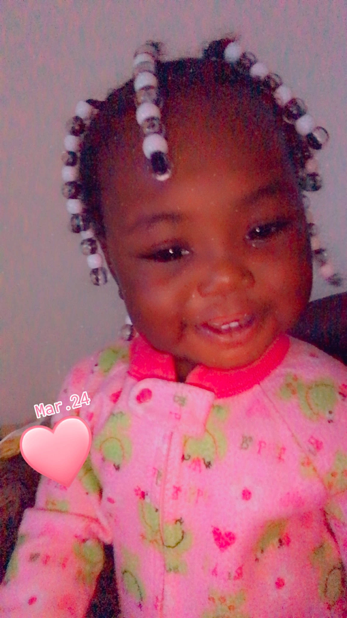 Aniyah joined the competition — help win amazing prizes! braid, cheek, child, cornrows, eyebrow, face, forehead, hair, hair_accessory, hairstyle, head, joy, lip, neck, nose, person, pink, skin, smile, toddler