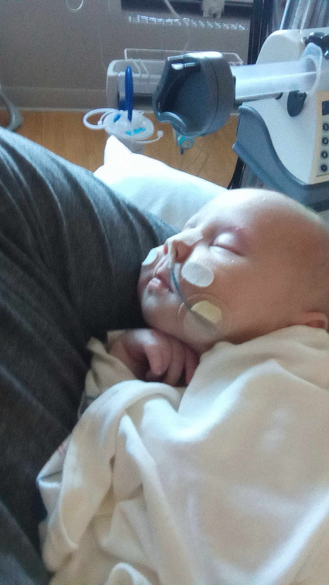 Ivy joined the competition — help win amazing prizes! baby, sleeping, blanket, medical_tubes, hospital, patient, infant, person, healthcare, resting, face, hand, white_clothing, closeup, care, indoor, young_child, medical_equipment, comfort, peaceful