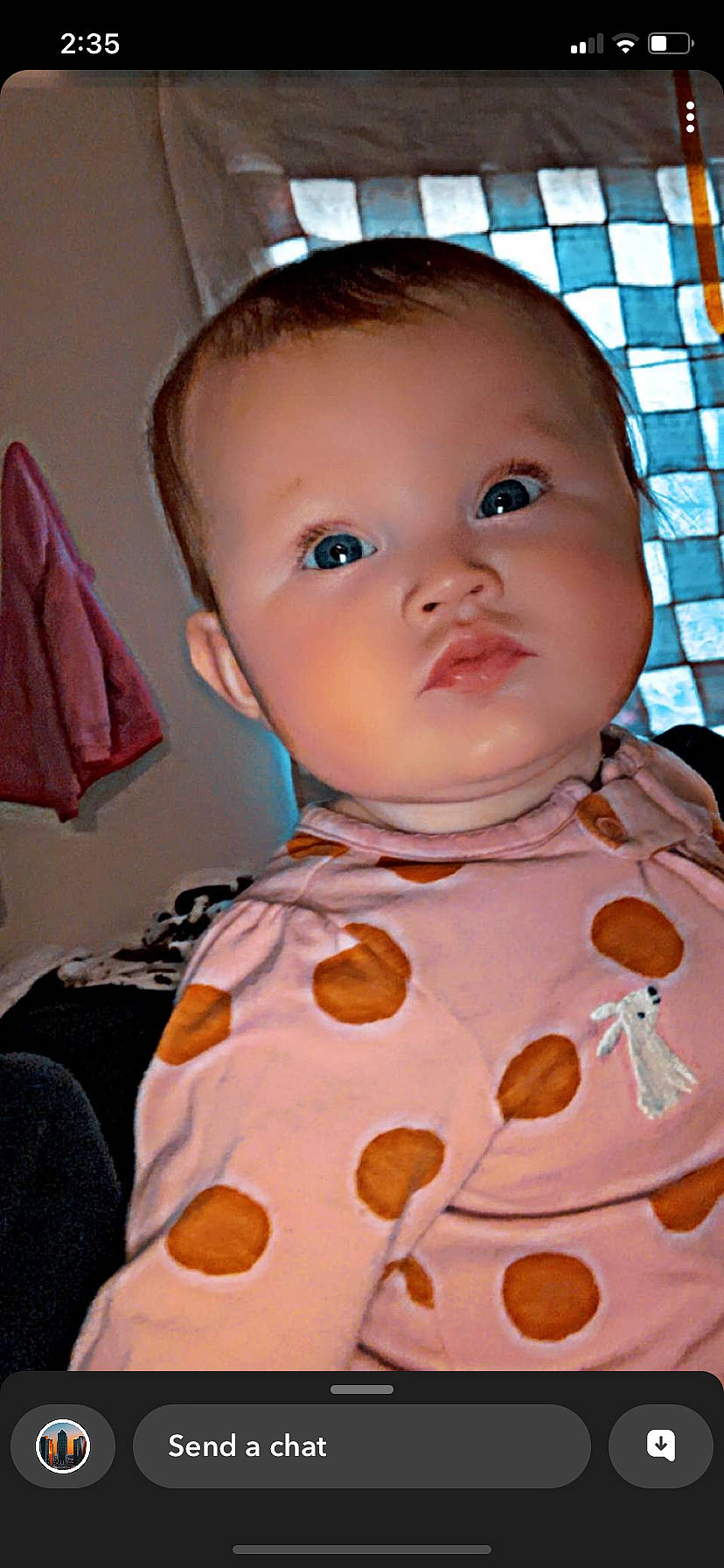 Ava joined the competition — help win amazing prizes! baby, baby_toddler_clothing, blue, cheek, child, chin, eye, eyelash, face, facial_expression, head, iris, lip, neck, nose, pattern, person, pink, skin, sleeve