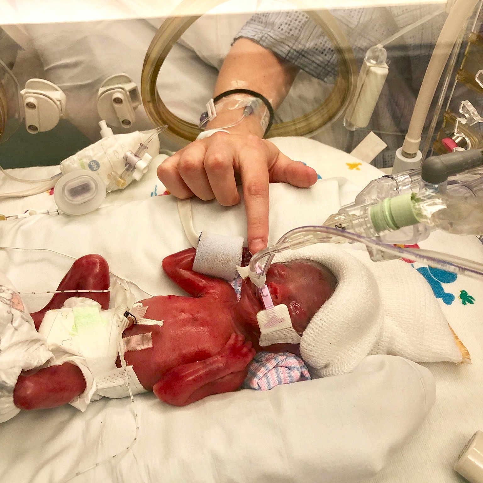 Rylah is registered to the contest to win money with this photo: baby, birth, child, childbirth, ear, flesh, hospital, patient