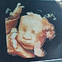 Ismaël participe au concours pour gagner de l'argent avec cette photo : 3d_ultrasound, baby, fetus, prenatal, womb, medical_image, scan, face, hands, sepia_tone, pregnancy, healthcare, soft_focus, infant, life, development, human, biology, sonogram, gestation