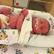 Chaseton is registered to the contest to win money with this photo: baby, bed, blanket, child, cute, diaper, face, healthcare, hospital, incubator, infant, lying_down, medical_care, medical_tubes, monitoring_wires, newborn, nursery, patient, skin, small