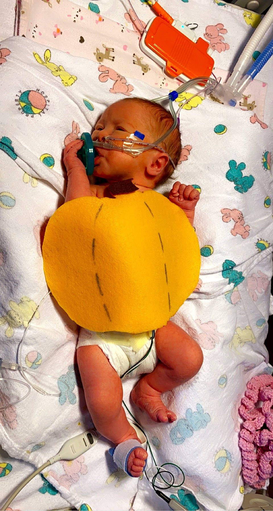 Axel is registered to the contest to win money with this photo: abdomen, art, baby, baby_toddler_clothing, child, event, face, fun, happy, human_leg, knee, linens, orange, pattern, person, shorts, sunglasses, textile, thigh, toddler