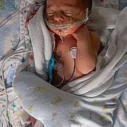 Elias joined the competition — help win amazing prizes! baby, bed, blanket, cute, face, feet, hand, healthcare, hospital, infant, medical_tubes, monitoring_electrodes, newborn, pacifier, pediatric, resting, sleeping, soft, swaddled, tubes