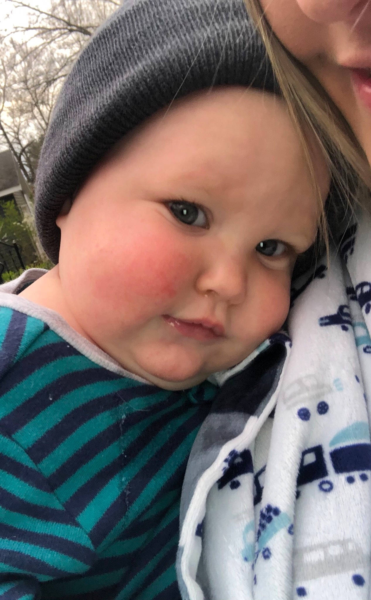 Brecken is registered to the contest to win money with this photo: beauty, cap, cheek, child, clothing, collar, cool, dress_shirt, eyelash, face, grass, happy, lip, nose, outerwear, person, plant, skin, toddler, tree