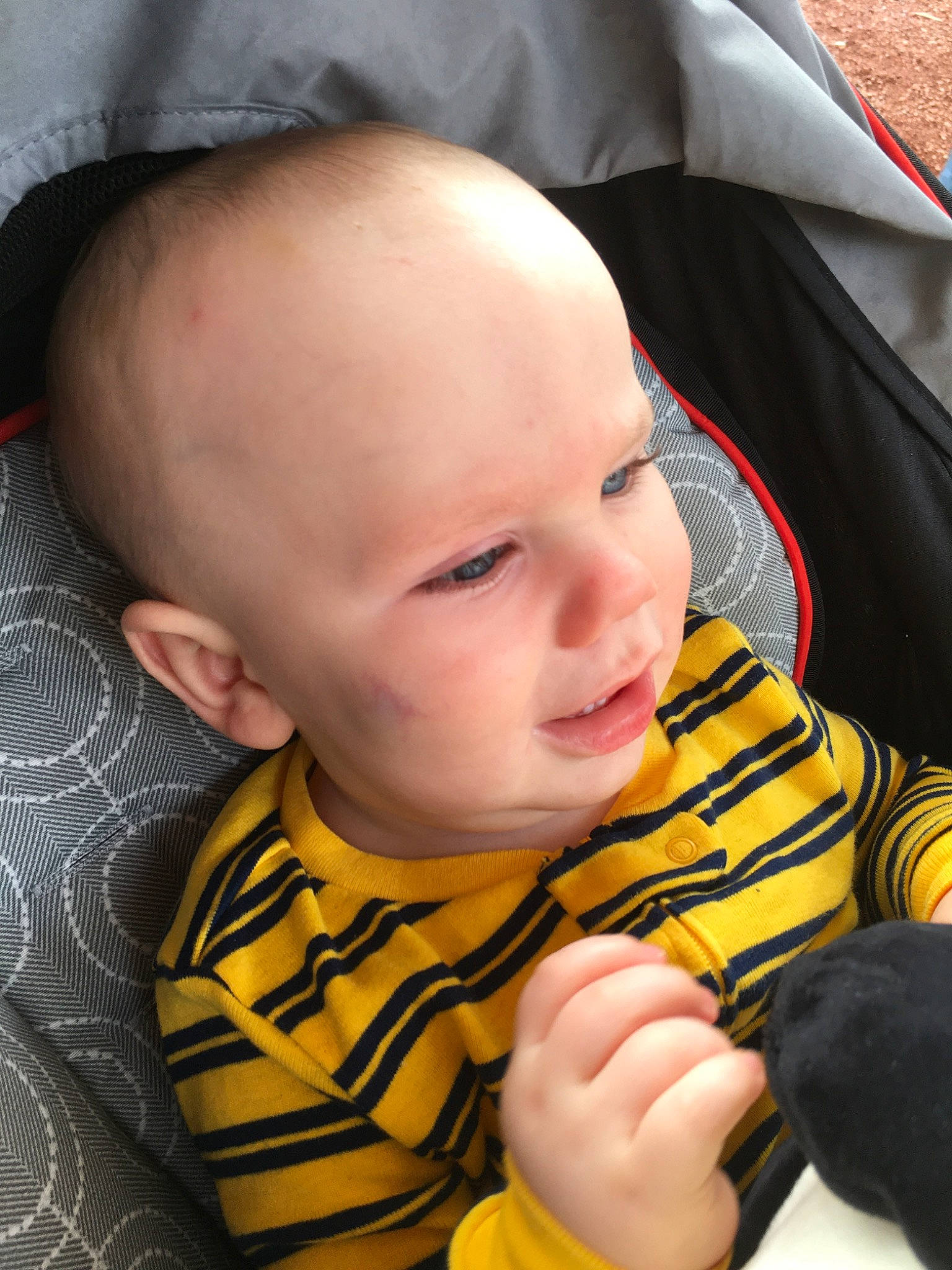 Kellan is registered to the contest to win money with this photo: baby, cheek, child, face, finger, head, lip, mouth, nose, person, skin, thumb, toddler