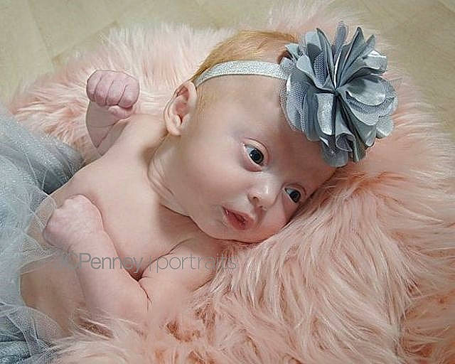 Ainsleigh is registered to the contest to win money with this photo: baby, beauty, cheek, child, ear, eye, face, fashion_accessory, forehead, fur, hair, hair_accessory, head, headband, headgear, headpiece, person, pink, product, skin