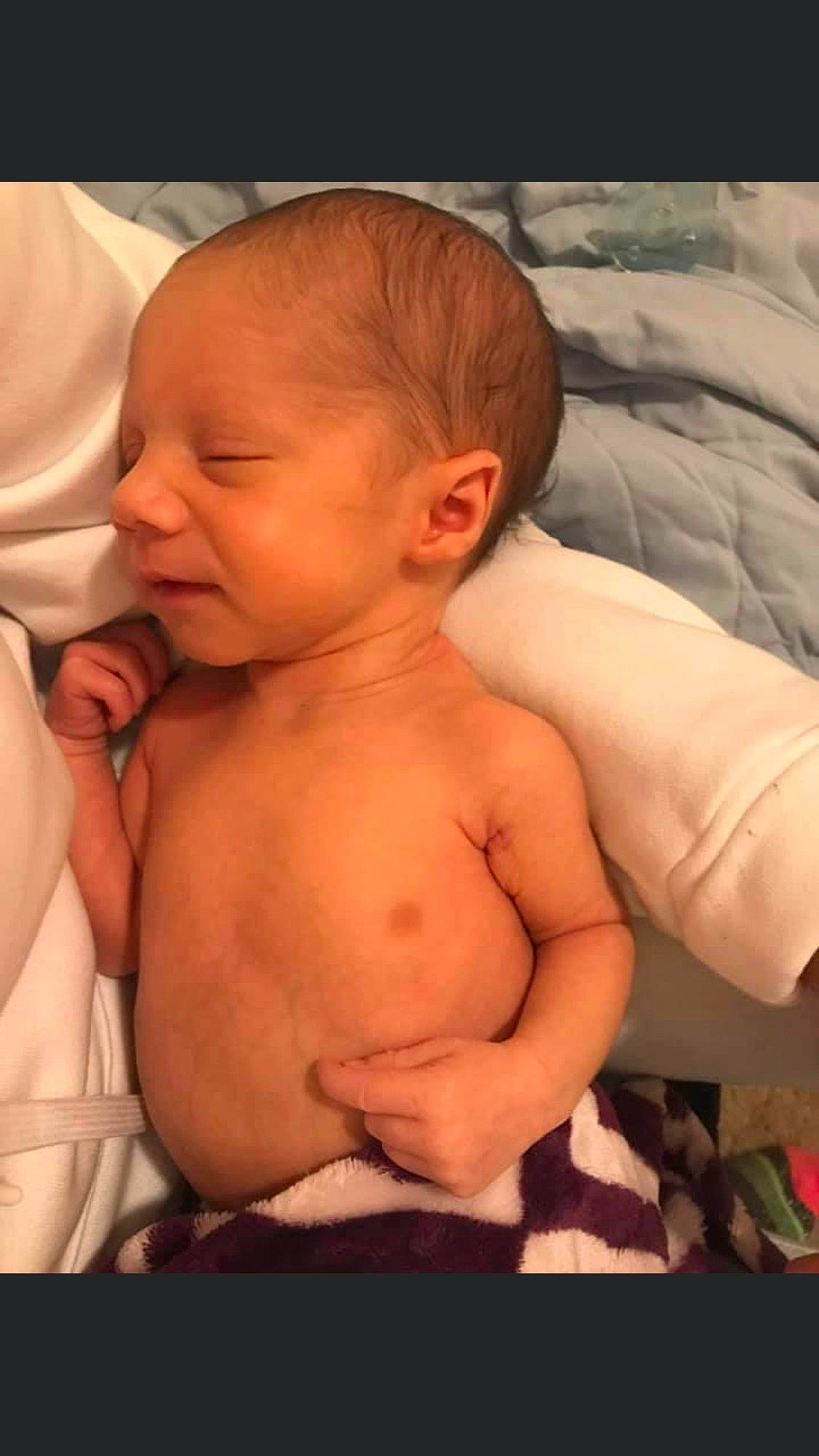 Eli joined the competition — help win amazing prizes! arm, baby, cheek, chest, comfort, ear, eyebrow, finger, forehead, hand, human_body, lip, mouth, neck, nose, person, skin, stomach, thumb, toddler