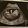 animal, black_and_white, cat, clinic, cute, diagnostic, fetus, funny, imaging, kitten, mammal, medical, pregnancy, scan, scan_image, small, striped, technology, ultrasound, veterinary