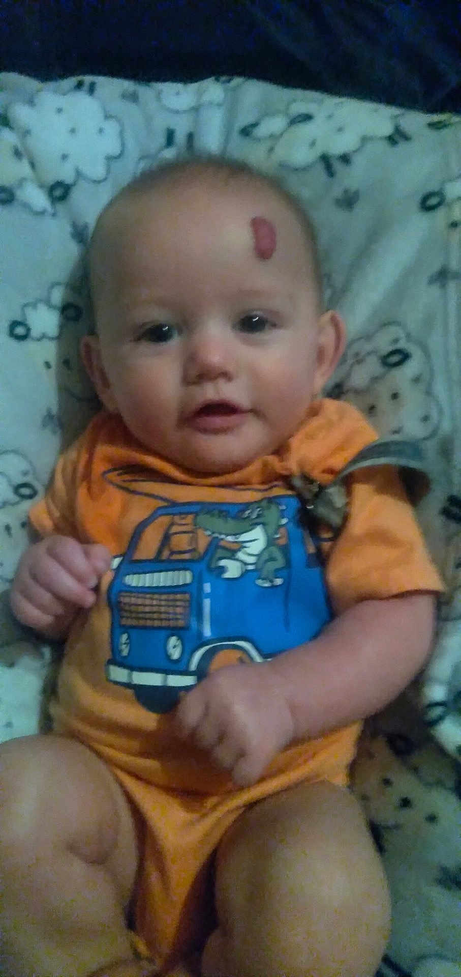 Adam joined the competition — help win amazing prizes! baby, infant, child, orange_clothing, onesie, blue_truck, crocodile_design, blanket, cloud_pattern, skin_mark, face, head, hands, legs, sitting, cute, indoors, portrait, young, person