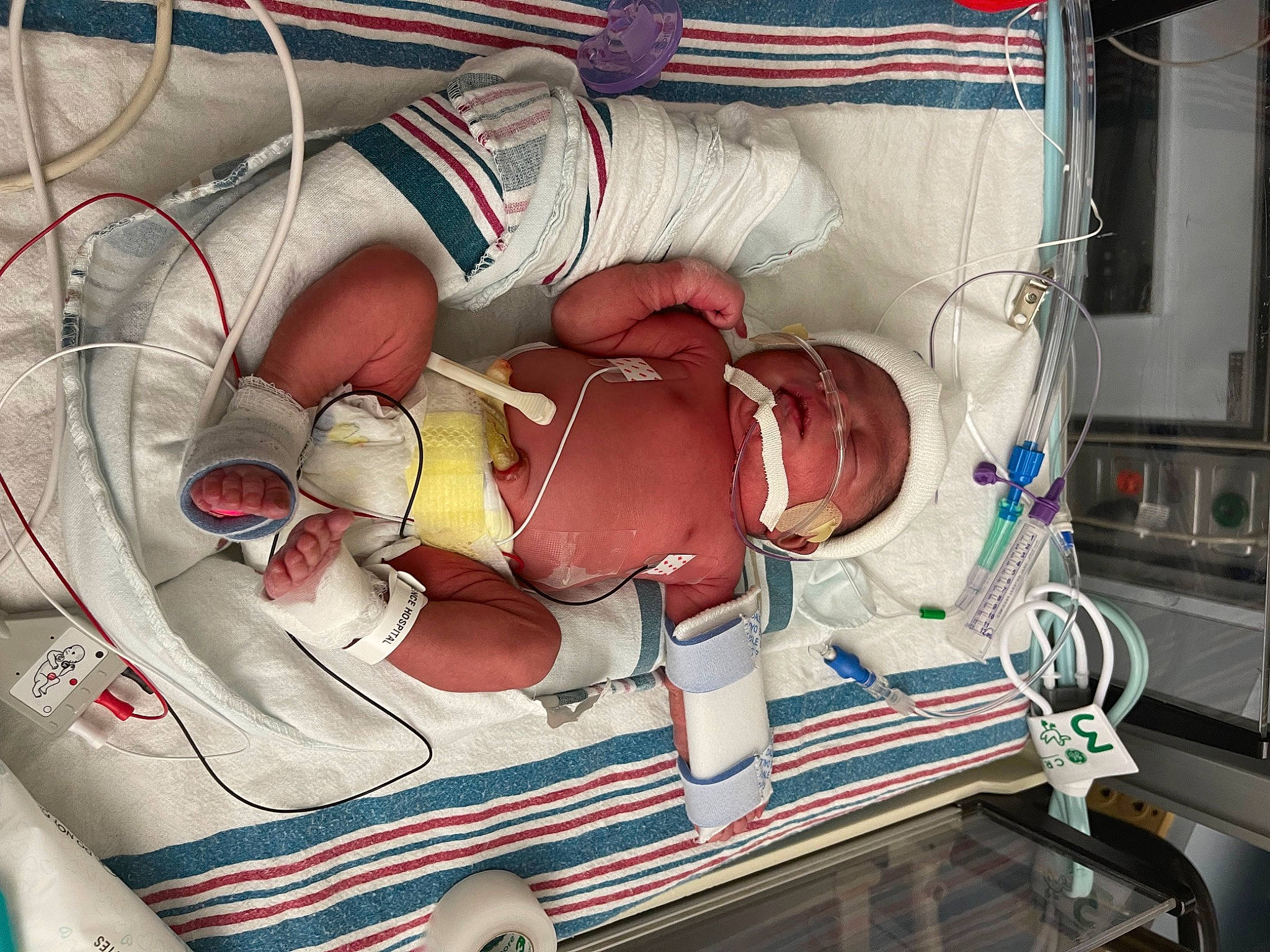 Jorri joined the competition — help win amazing prizes! abdomen, art, baby, carmine, chest, child, event, flesh, health_care, hospital, illustration, medical, medical_equipment, medical_procedure, patient, pediatrics, person, room, service, toddler