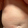 Finley joined the competition — help win amazing prizes! baby, belly, skin, diaper, infant, closeup, body, soft, human, child, torso, naked, cute, newborn, health, baby_skin, bellybutton, red_marks, baby_body, infant_skin