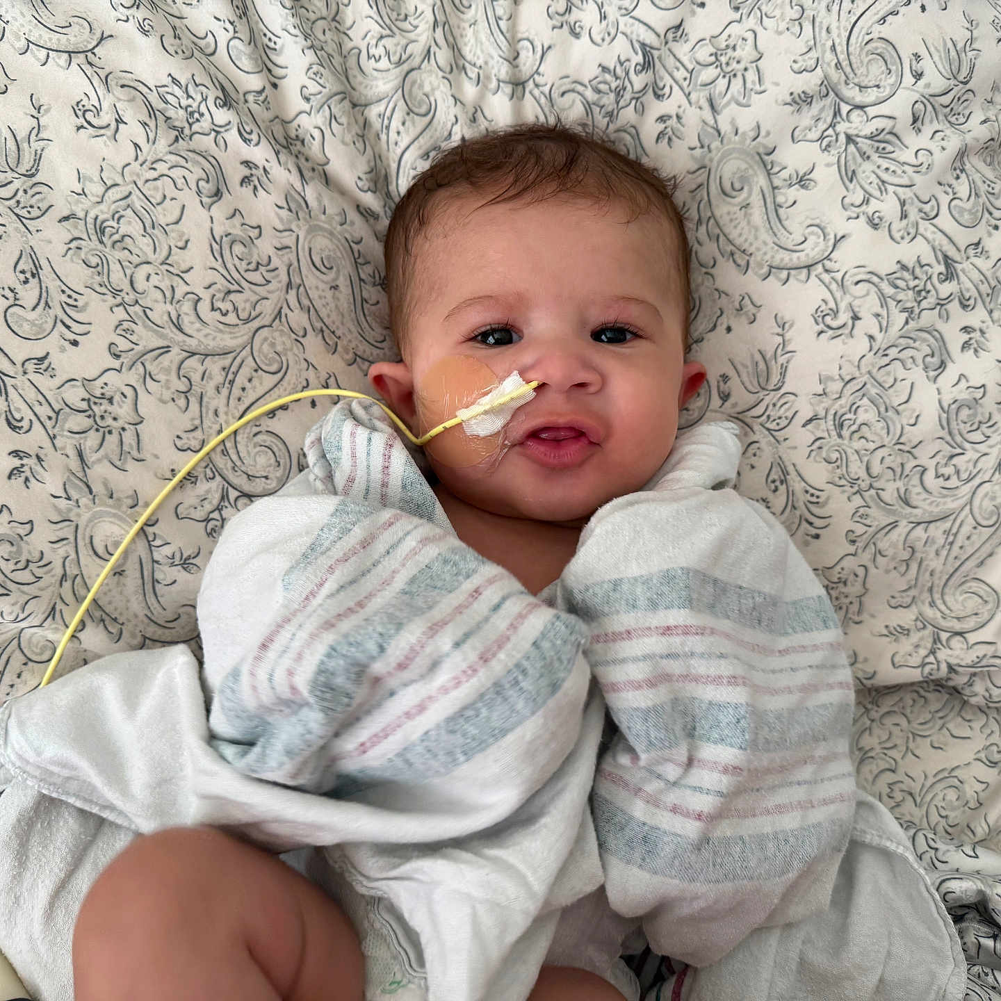 Kamari joined the competition — help win amazing prizes! baby, bed, blanket, cheek, clothing, comfort, cute, expression, face, feeding_tube, healthcare, indoors, infant, lying_down, medical_tube, patterned_bedspread, person, skin, striped_blanket, young_child