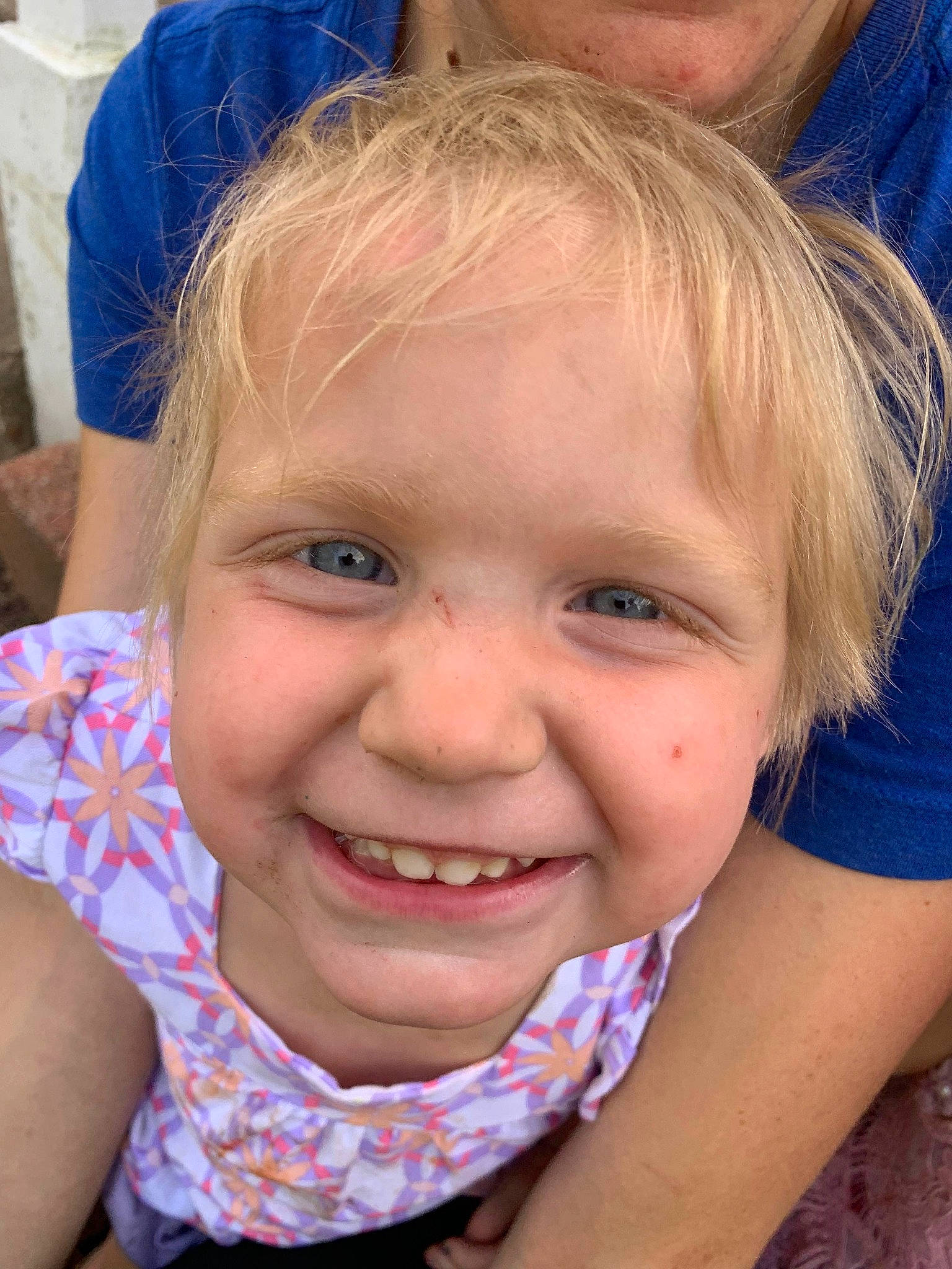 Malorie joined the competition — help win amazing prizes! arm, blue, cheek, chin, ear, eye, eyebrow, face, facial_expression, hair, hairstyle, head, joy, lip, mouth, nose, organ, person, shoulder, skin