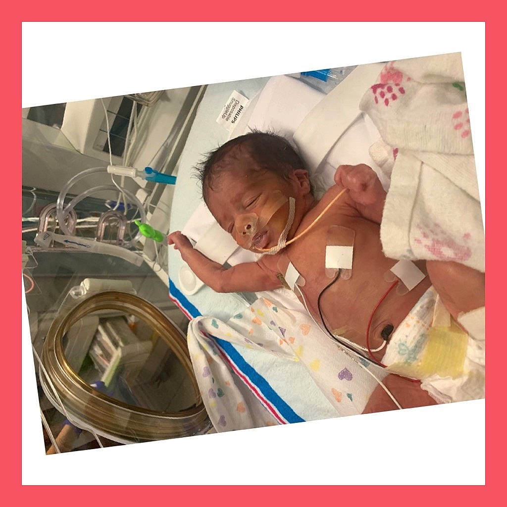 Dahlia is registered to the contest to win money with this photo: automotive_lighting, automotive_tire, automotive_wheel_system, baby, comfort, event, health_care, hospital, machine, medical, medical_equipment, medical_procedure, motor_vehicle, patient, person, product, rim, service, toddler, washing_machine