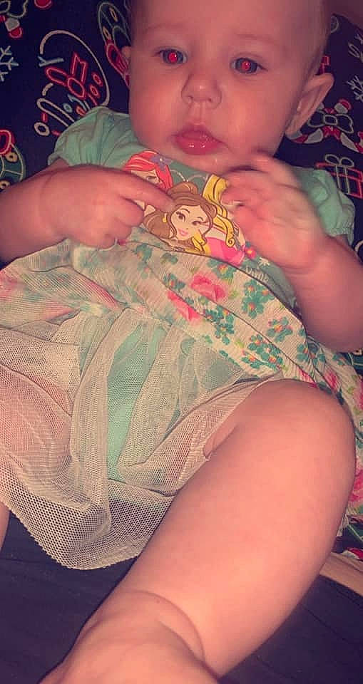 Cambree is registered to the contest to win money with this photo: arm, baby, child, finger, flesh, hand, leg, person, thigh, thumb, toddler