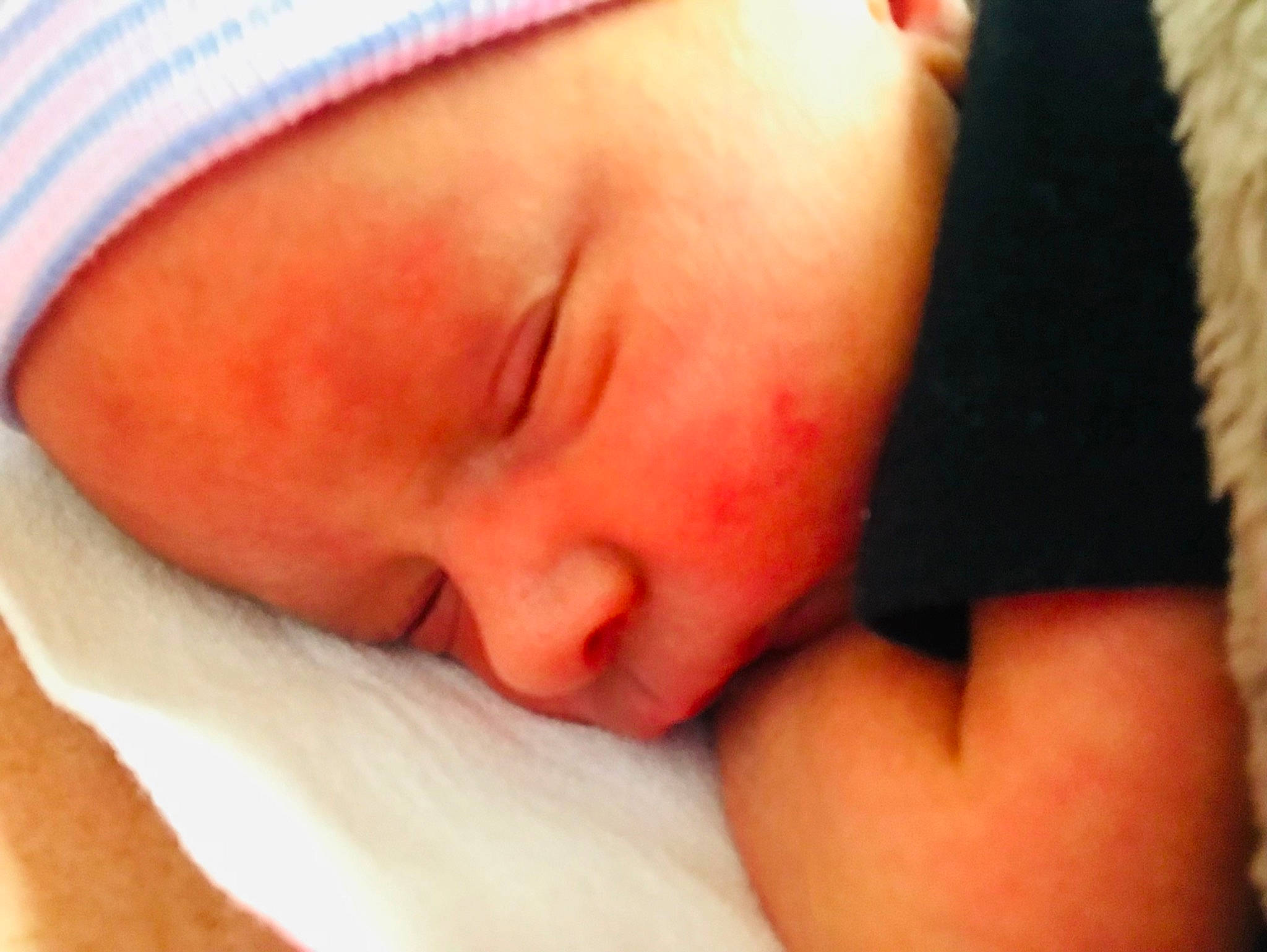 Noah is registered to the contest to win money with this photo: baby, bedtime, carmine, cheek, child, childbirth, chin, close_up, comfort, eyebrow, eyelash, finger, mouth, nap, nose, person, portrait_photography, skin, sleep, thumb