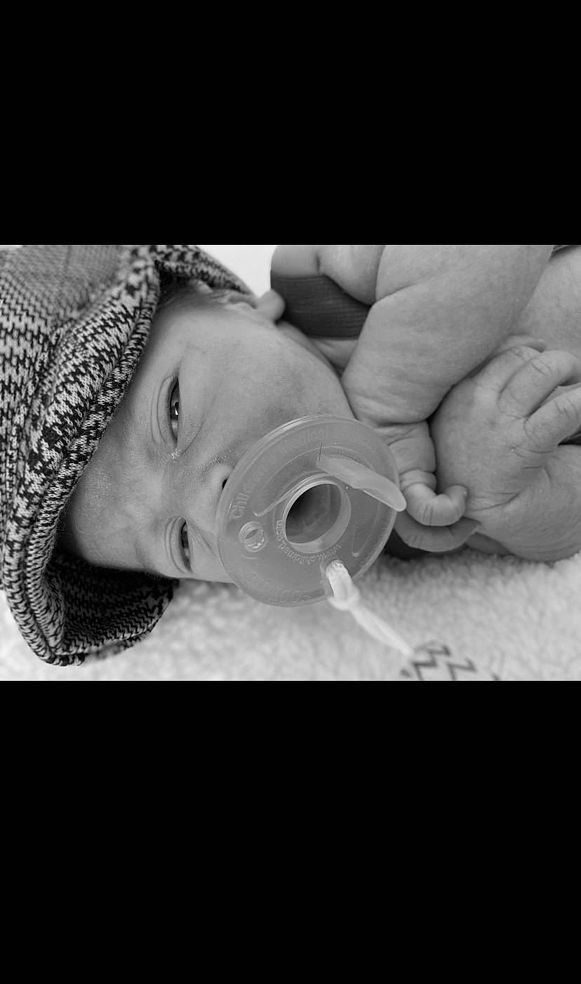 Elliot is registered to the contest to win money with this photo: baby, birth, black_and_white, child, facial_expression, hand, head, human, monochrome, monochrome_photography, mouth, nose, person, photograph, photography, portrait_photography, sleep, snapshot, snout, style