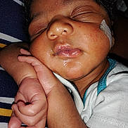 Kyson joined the competition — help win amazing prizes! baby, sleeping, face, hand, skin, bandage, closeup, infant, peaceful, cute, child, person, resting, pink, lips, curled_fingers, striped_fabric, white_clothing, soft_light, portrait