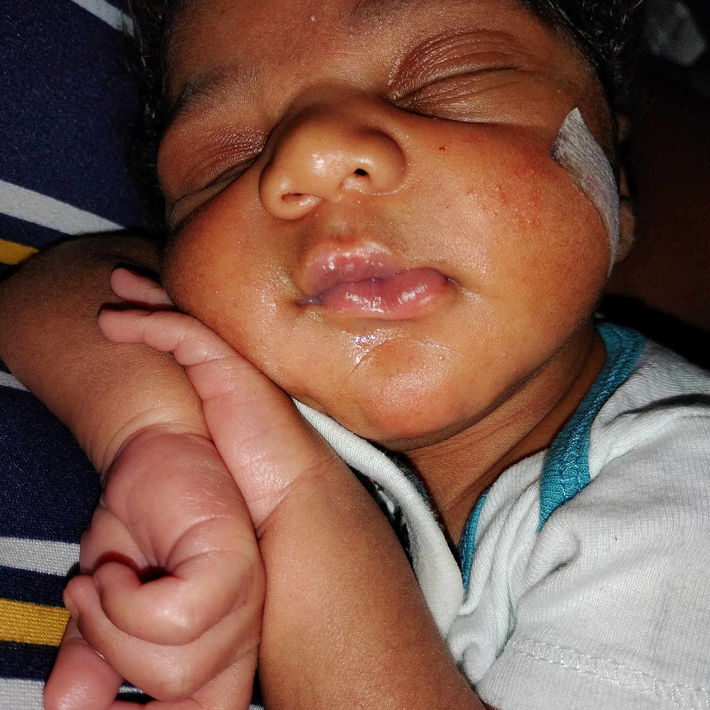 Kyson joined the competition — help win amazing prizes! baby, bandage, child, closeup, curled_fingers, cute, face, hand, infant, lips, peaceful, person, pink, portrait, resting, skin, sleeping, soft_light, striped_fabric, white_clothing