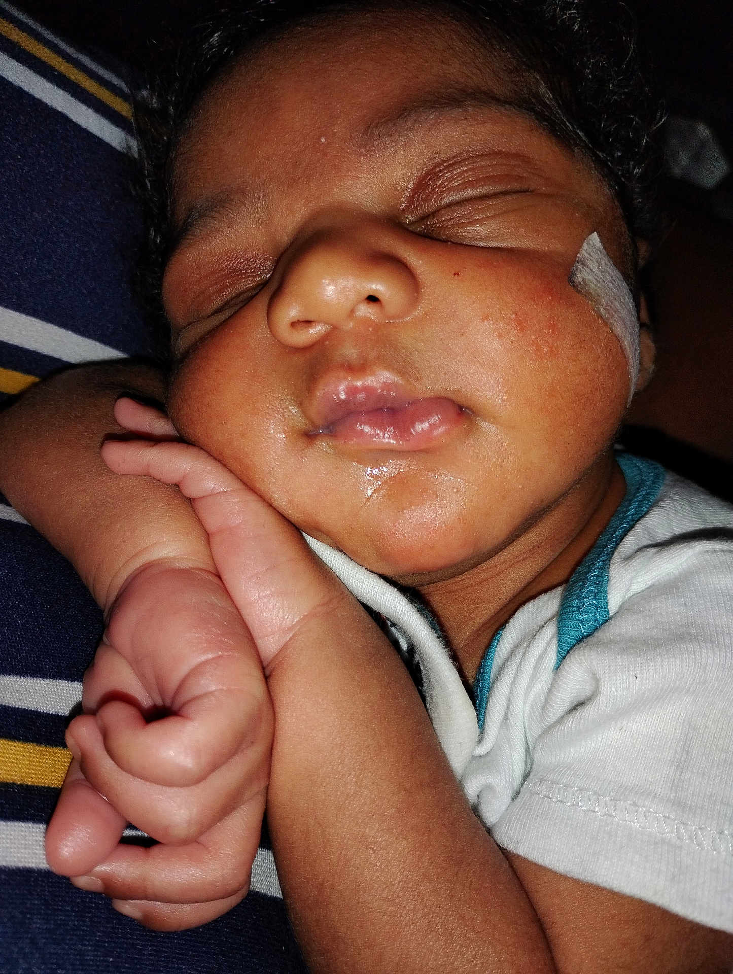 Kyson joined the competition — help win amazing prizes! baby, sleeping, face, hand, skin, bandage, closeup, infant, peaceful, cute, child, person, resting, pink, lips, curled_fingers, striped_fabric, white_clothing, soft_light, portrait