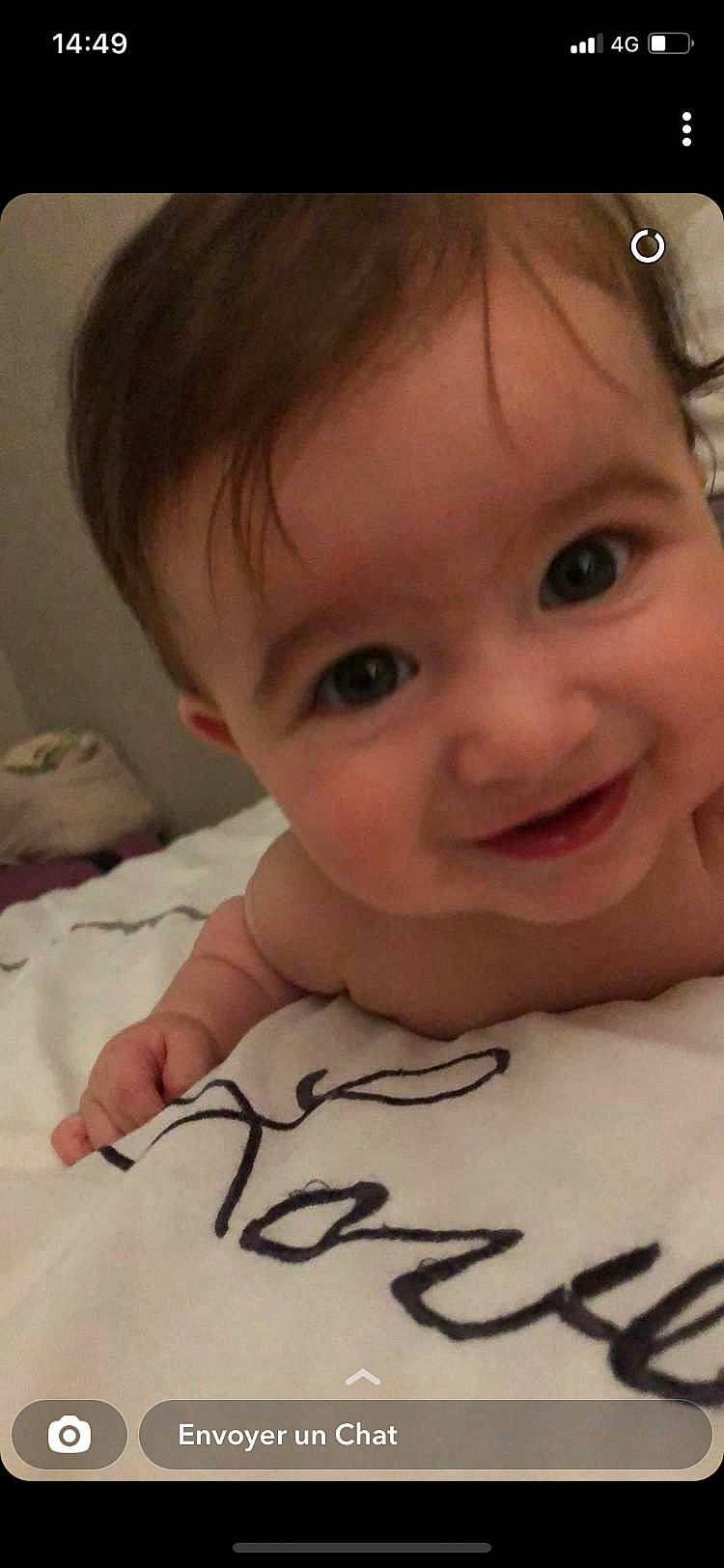 Loann participe au concours pour gagner de l'argent avec cette photo : arm, cheek, chin, ear, eye, eyebrow, eyelash, face, forehead, hair, head, human_body, jaw, lip, mouth, muscle, neck, nose, person, skin