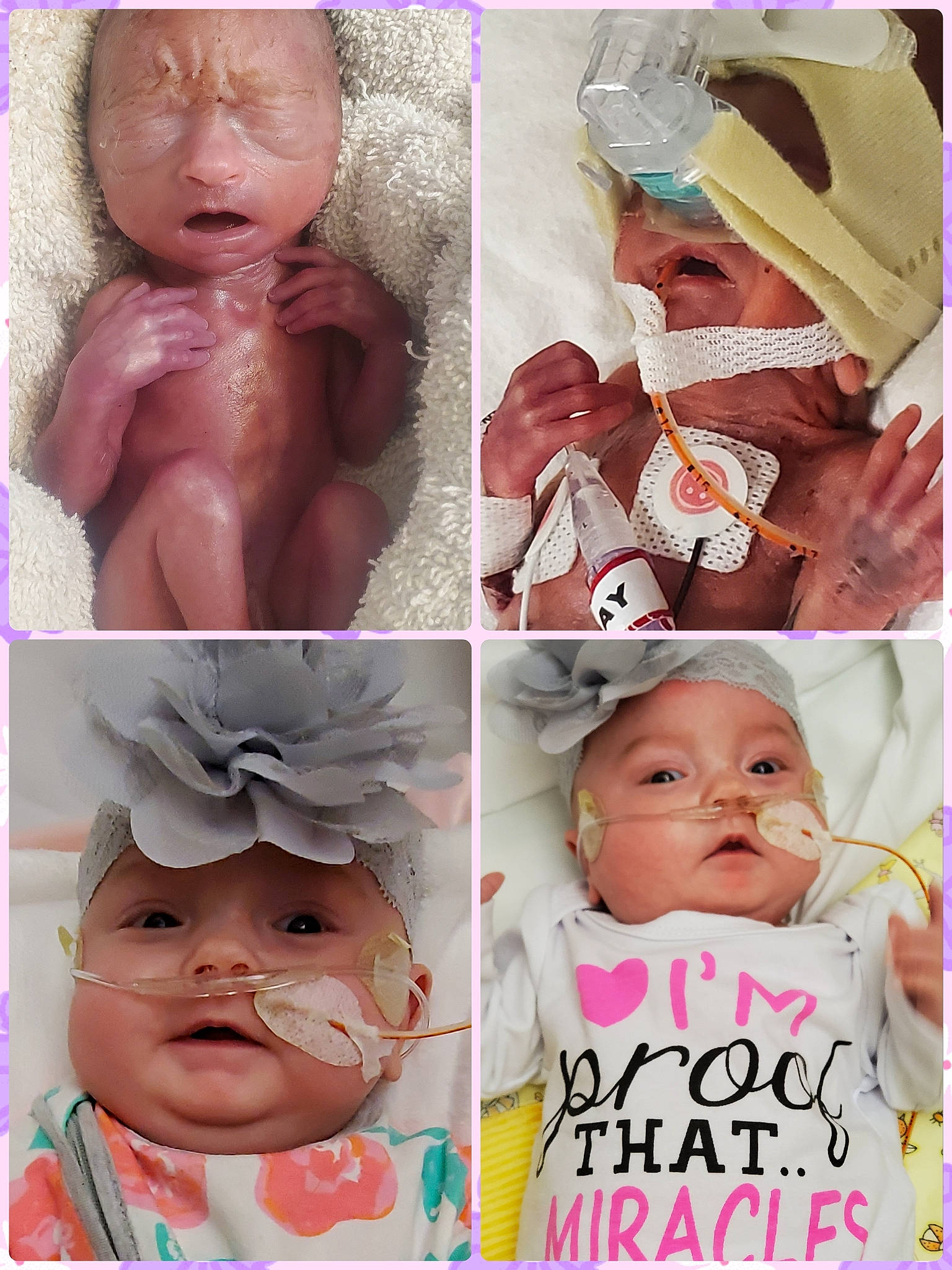 Braelynn is registered to the contest to win money with this photo: art, baby, birth, cheek, child, collage, face, facial_expression, forehead, head, headwear, lip, nose, person, photo_caption, photography, photomontage, pink, skin, smile