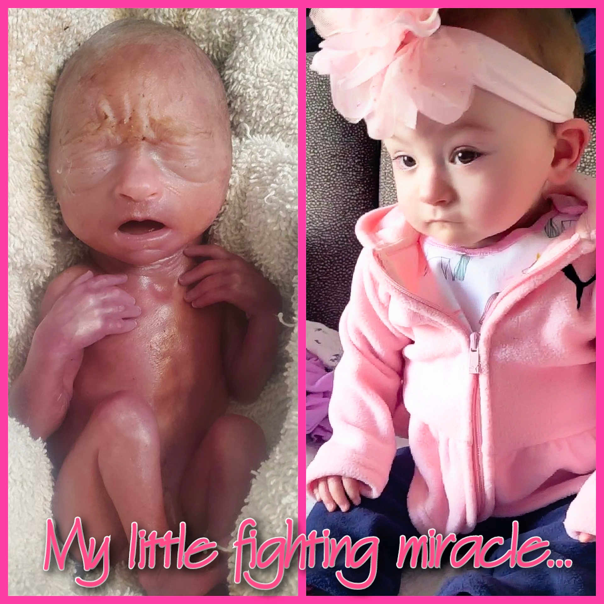 Braelyn