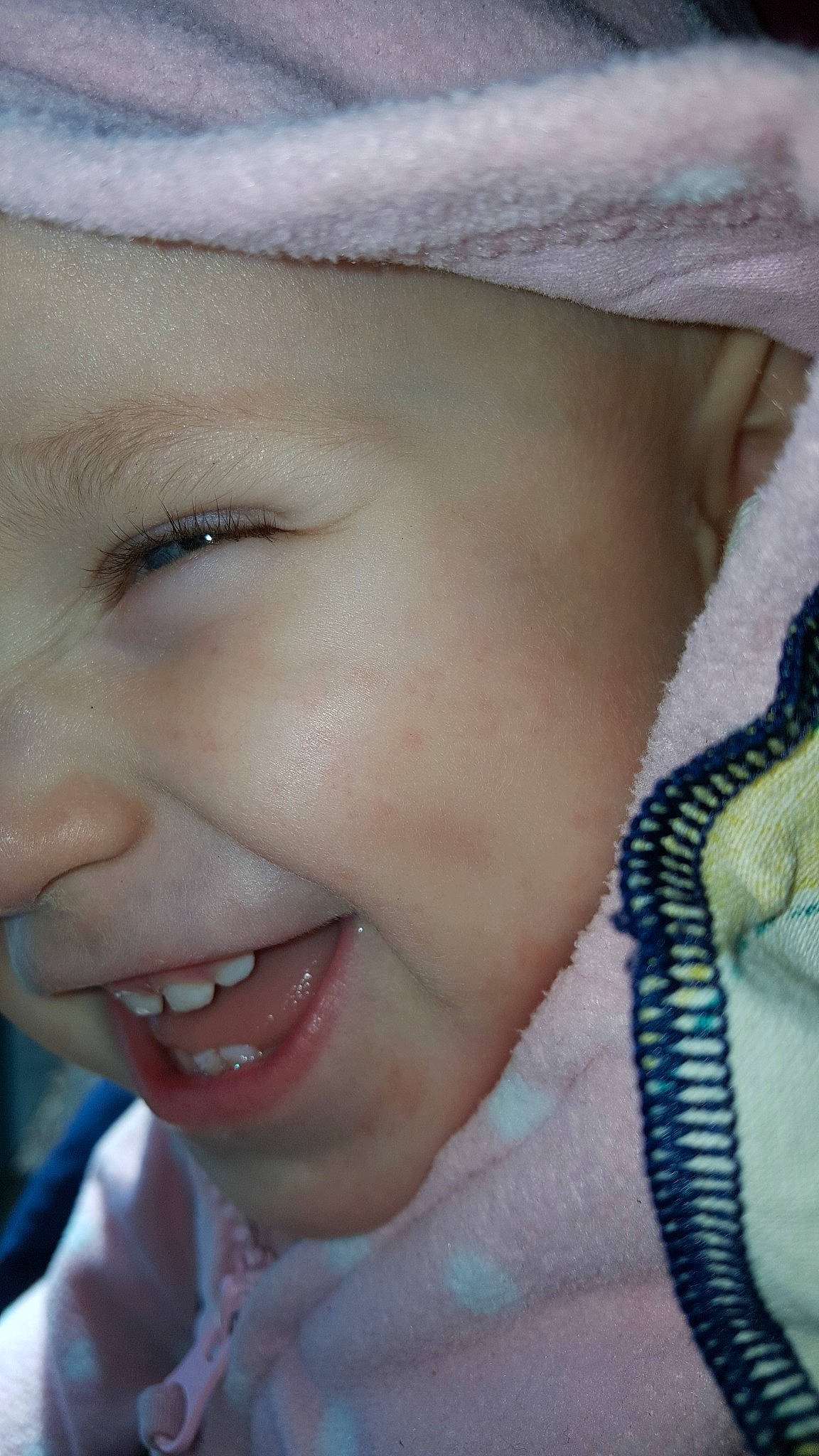 Lilly-rose joined the competition — help win amazing prizes! baby, cheek, child, chin, close_up, ear, eye, eyebrow, eyelash, face, facial_expression, forehead, head, jaw, lip, mouth, nose, person, skin, smile