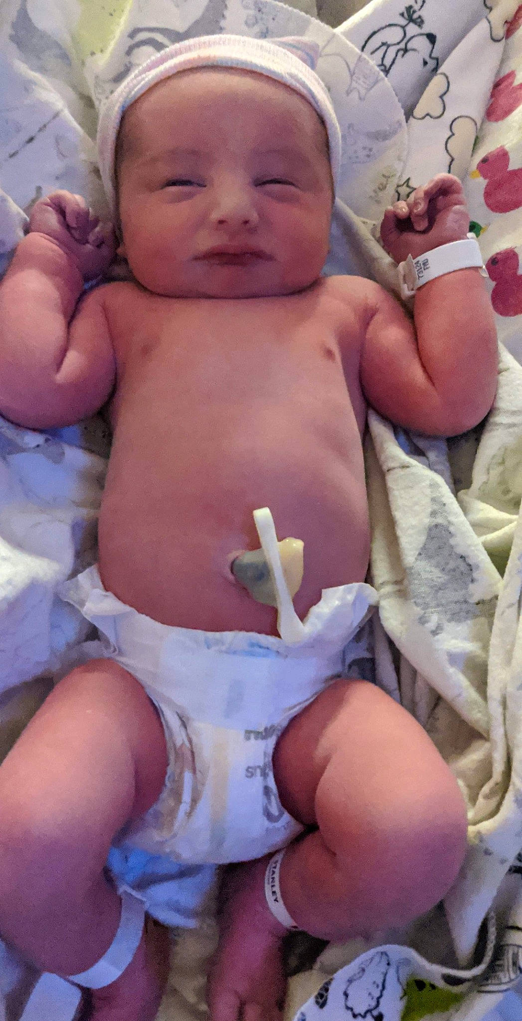 Ryker joined the competition — help win amazing prizes! arm, baby, cheek, eye, face, finger, hand, head, human_body, joint, leg, mouth, muscle, nose, organ, person, photograph, skin, stomach, thumb