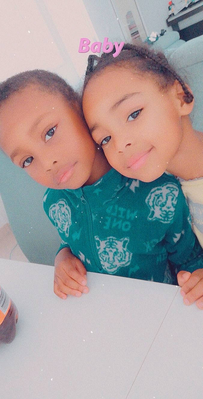 Kaïly participe au concours pour gagner de l'argent avec cette photo : baby_toddler_clothing, cheek, child, ear, eye, eyebrow, eyelash, finger, forehead, hair_accessory, hand, happy, head, iris, joy, lip, mouth, nail, nose, person