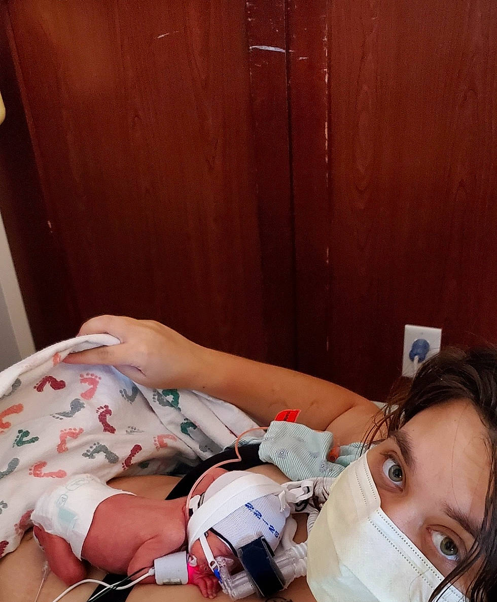 Jesse is registered to the contest to win money with this photo: comfort, elbow, eye, eyelash, head, health_care, hearing, human_leg, joint, knee, medical, medical_equipment, medical_procedure, mouth, muscle, patient, person, service, shoulder, skin