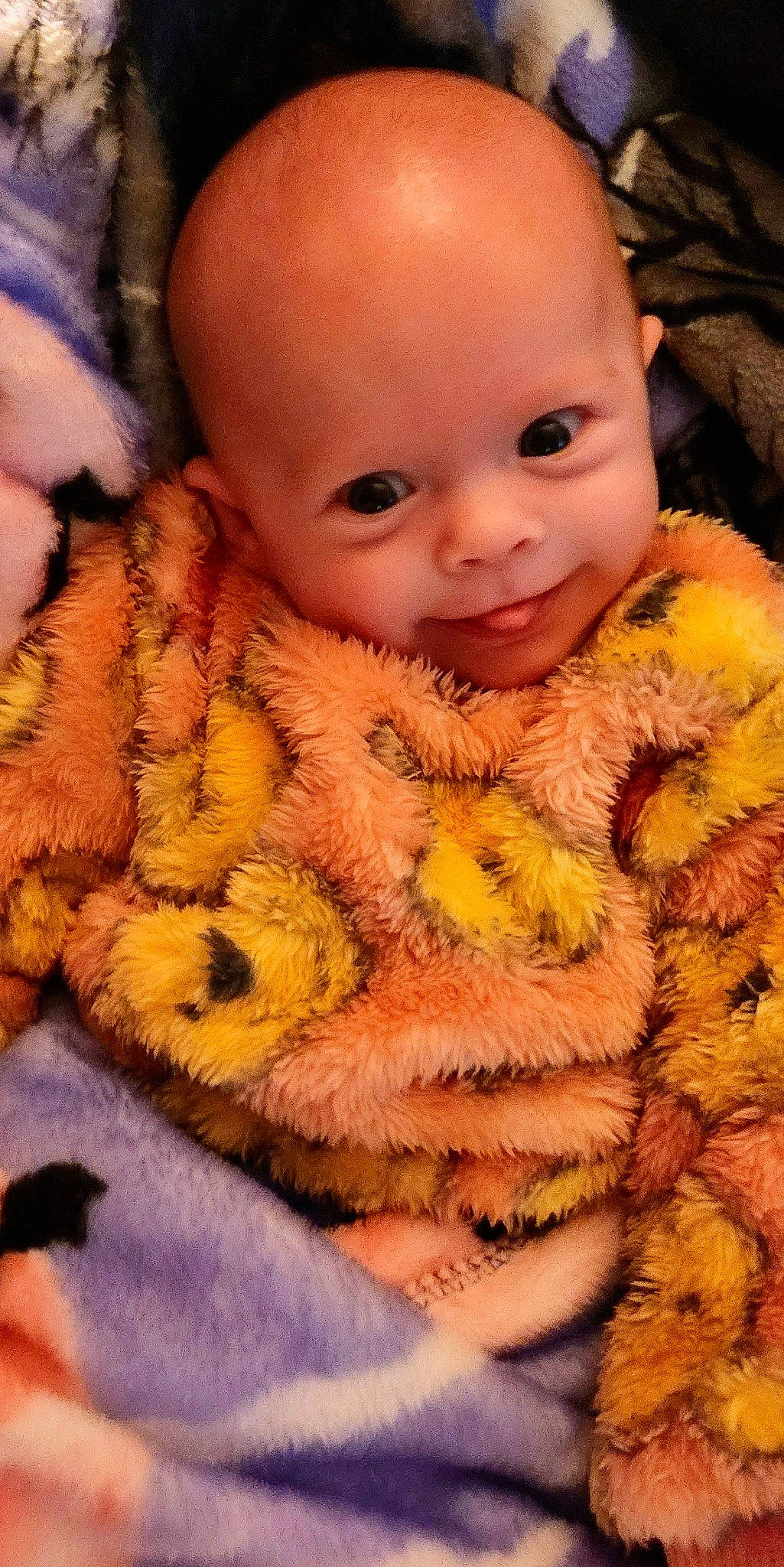 Alarra is registered to the contest to win money with this photo: baby, baby_products, baby_toddler_clothing, cheek, child, comfort, fur, linens, nail, nose, orange, peach, person, pink, plush, skin, stuffed_toy, textile, toddler, toy