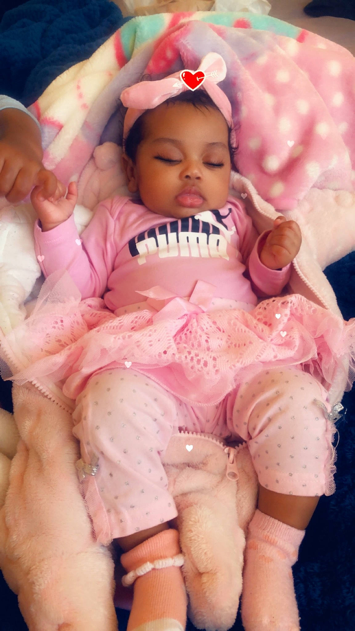 Jailee is registered to the contest to win money with this photo: baby, cheek, child, mouth, person, pink, skin, toddler