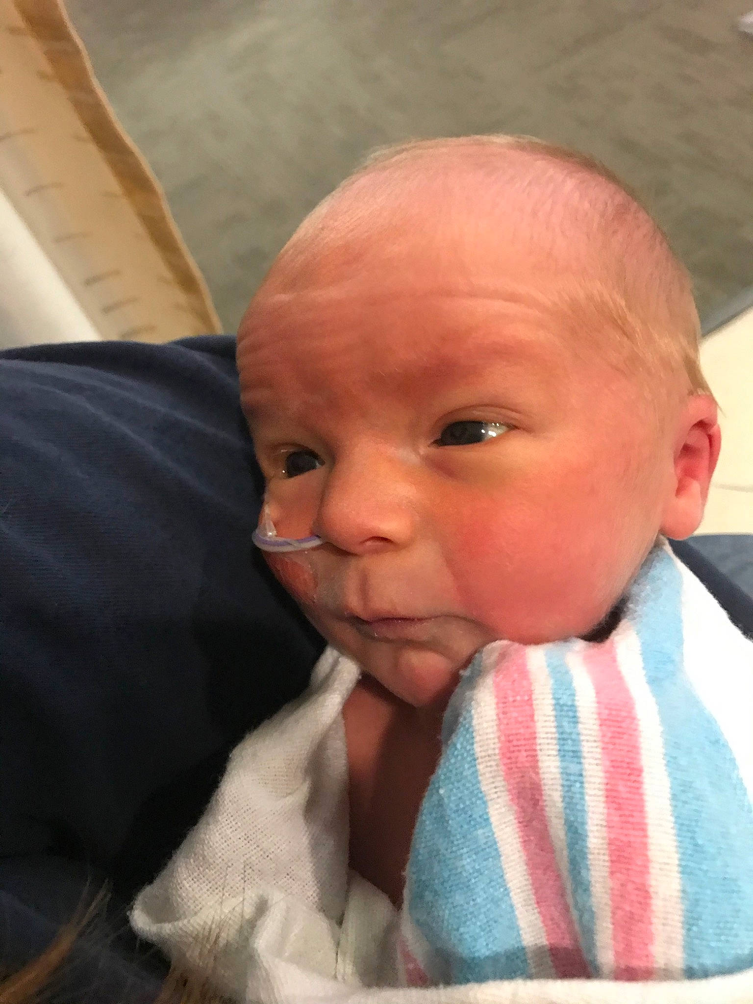 Breklen is registered to the contest to win money with this photo: baby, cheek, child, chin, close_up, ear, eye, face, forehead, head, iris, lip, mouth, nose, person, skin, smile, toddler