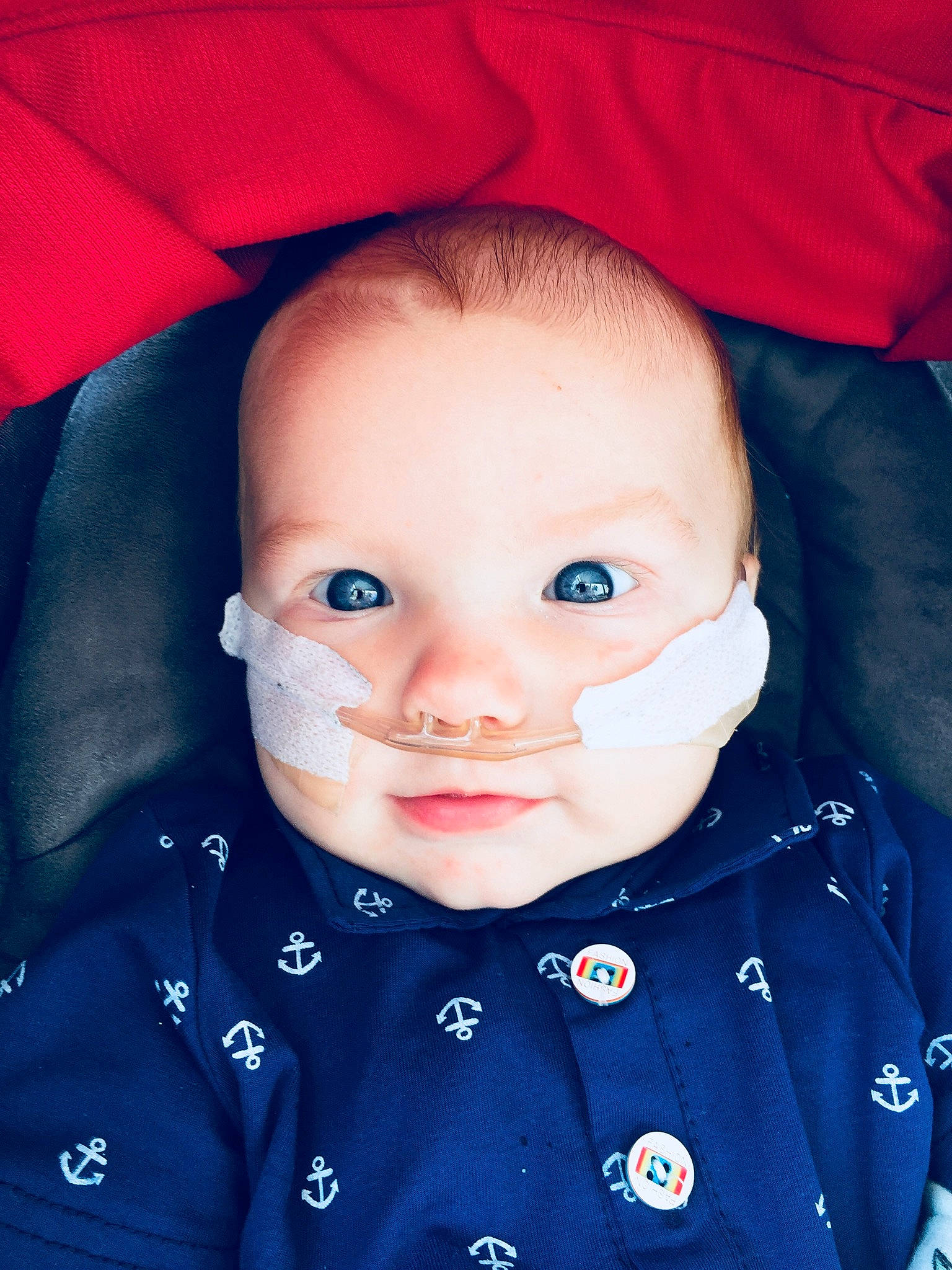 Isaiah joined the competition — help win amazing prizes! baby, beauty, blue, cheek, child, chin, eye, eyebrow, face, facial_expression, forehead, head, lip, mouth, nose, organ, person, red, skin, smile