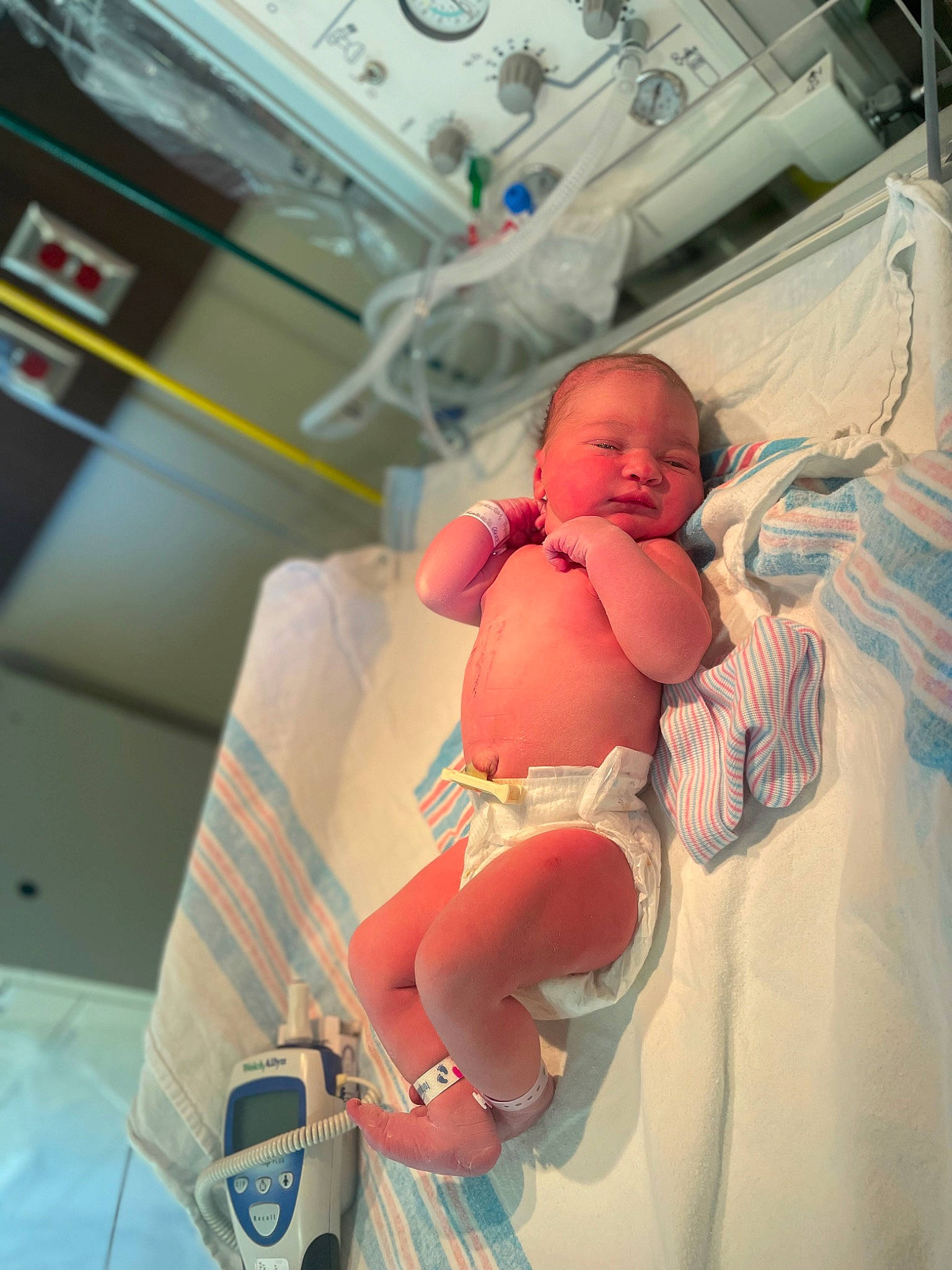 Nayeli is registered to the contest to win money with this photo: abdomen, baby, chest, clock, comfort, event, health_care, hospital, hospital_bed, human_leg, medical, medical_equipment, medical_procedure, mouth, patient, person, room, skin, stomach, toddler