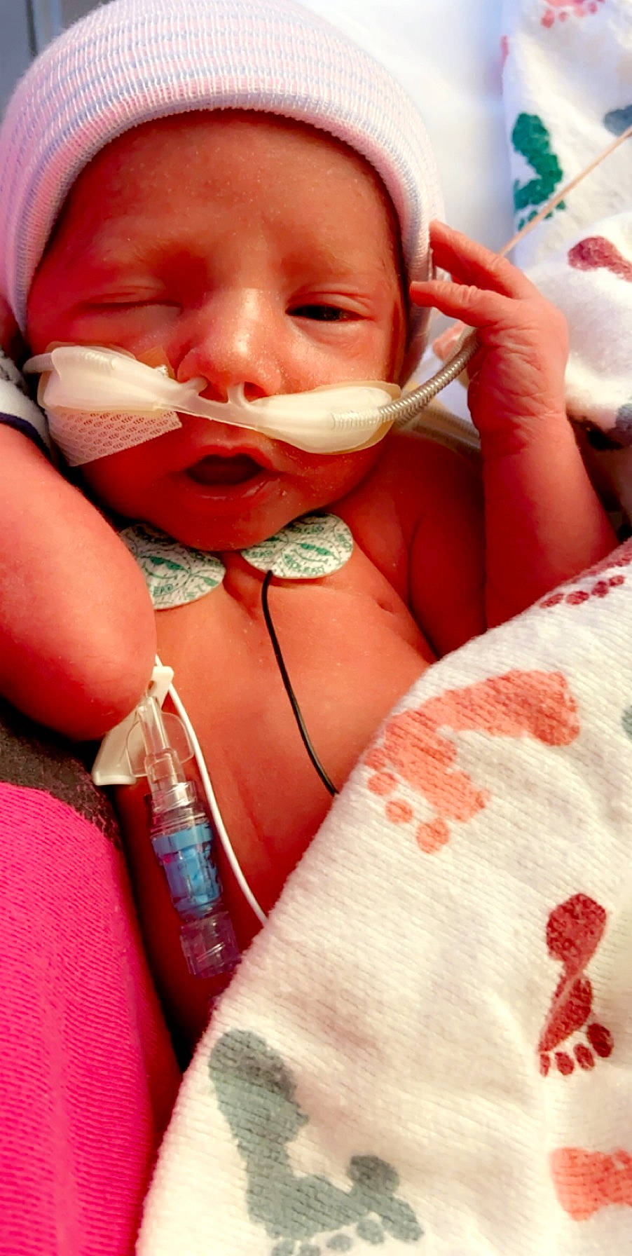 Boston joined the competition — help win amazing prizes! baby, birth, cheek, child, finger, lip, mouth, nail, nose, person, skin, smile, toddler, tooth