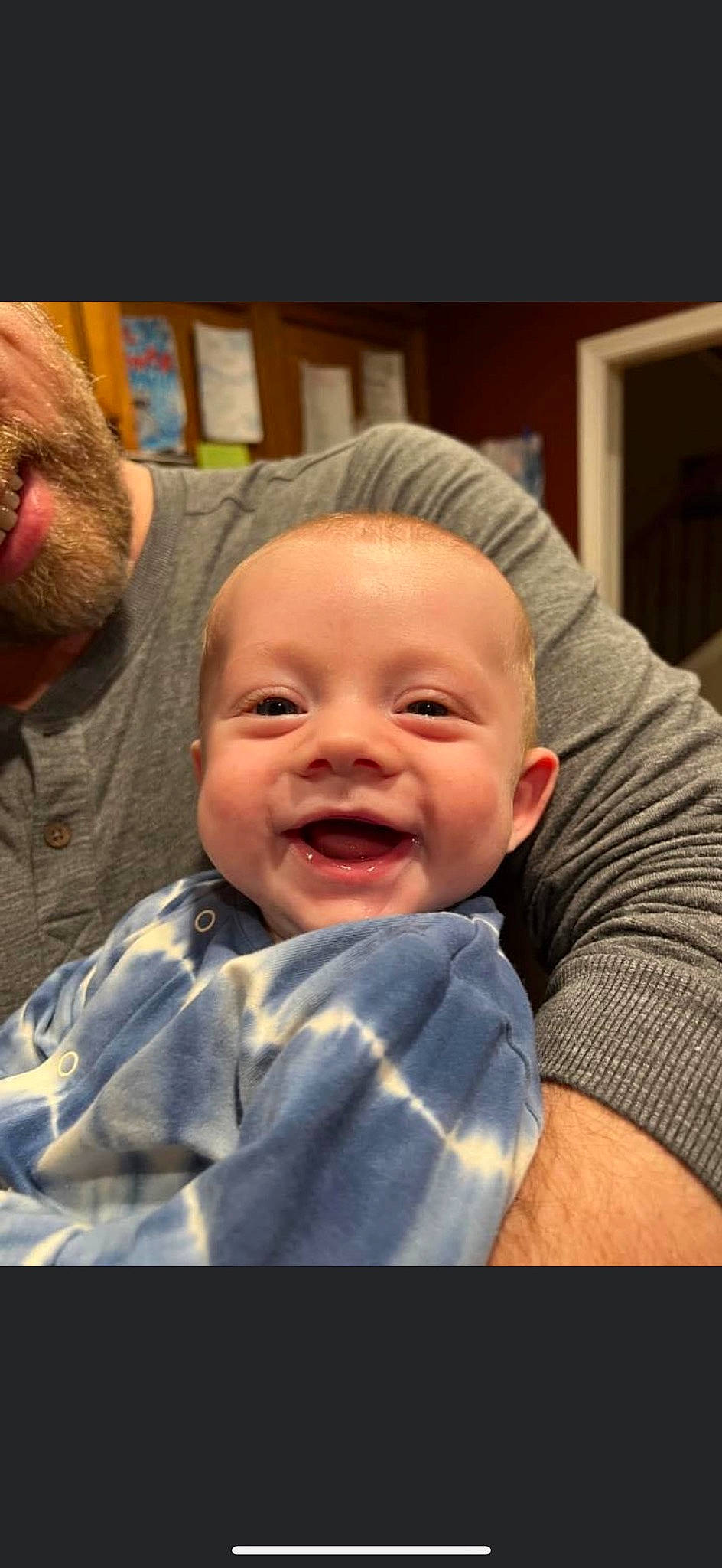 Charlie is registered to the contest to win money with this photo: baby, baby_laughing, cheek, comfort, ear, eye, eyebrow, forehead, fun, gesture, hair, happy, human_body, iris, joy, mouth, nose, person, skin, smile