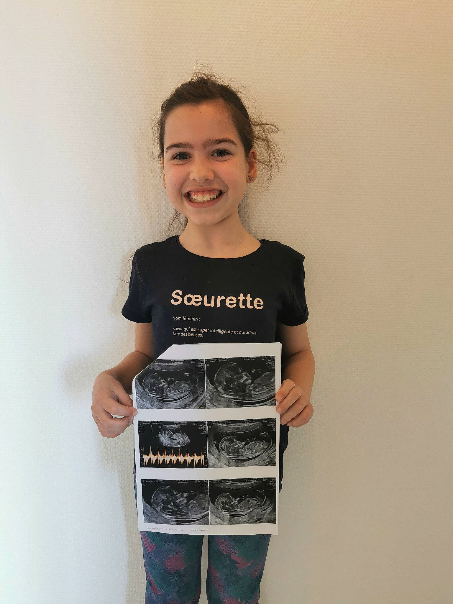 Danaé participe au concours pour gagner de l'argent avec cette photo : active_shirt, child, child_model, denim, elbow, electric_blue, fashion_design, font, hair, happy, joy, knee, pattern, person, shorts, sleeve, smile, street_fashion, t_shirt, thigh