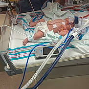 Carmen is registered to the contest to win money with this photo: baby, hospital, incubator, medical_equipment, blanket, diaper, tubes, sensor, floor, person, healthcare, monitor, bed, footwear, nurse, medical_care, striped_blanket, infant, oxygen_mask, wires