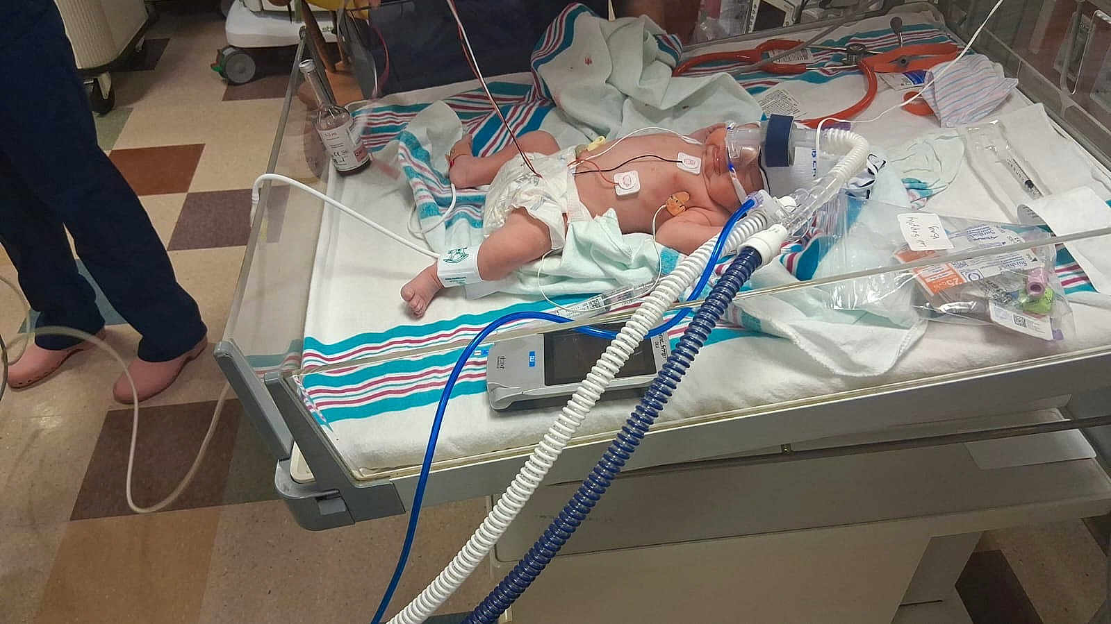 Carmen is registered to the contest to win money with this photo: baby, hospital, incubator, medical_equipment, blanket, diaper, tubes, sensor, floor, person, healthcare, monitor, bed, footwear, nurse, medical_care, striped_blanket, infant, oxygen_mask, wires
