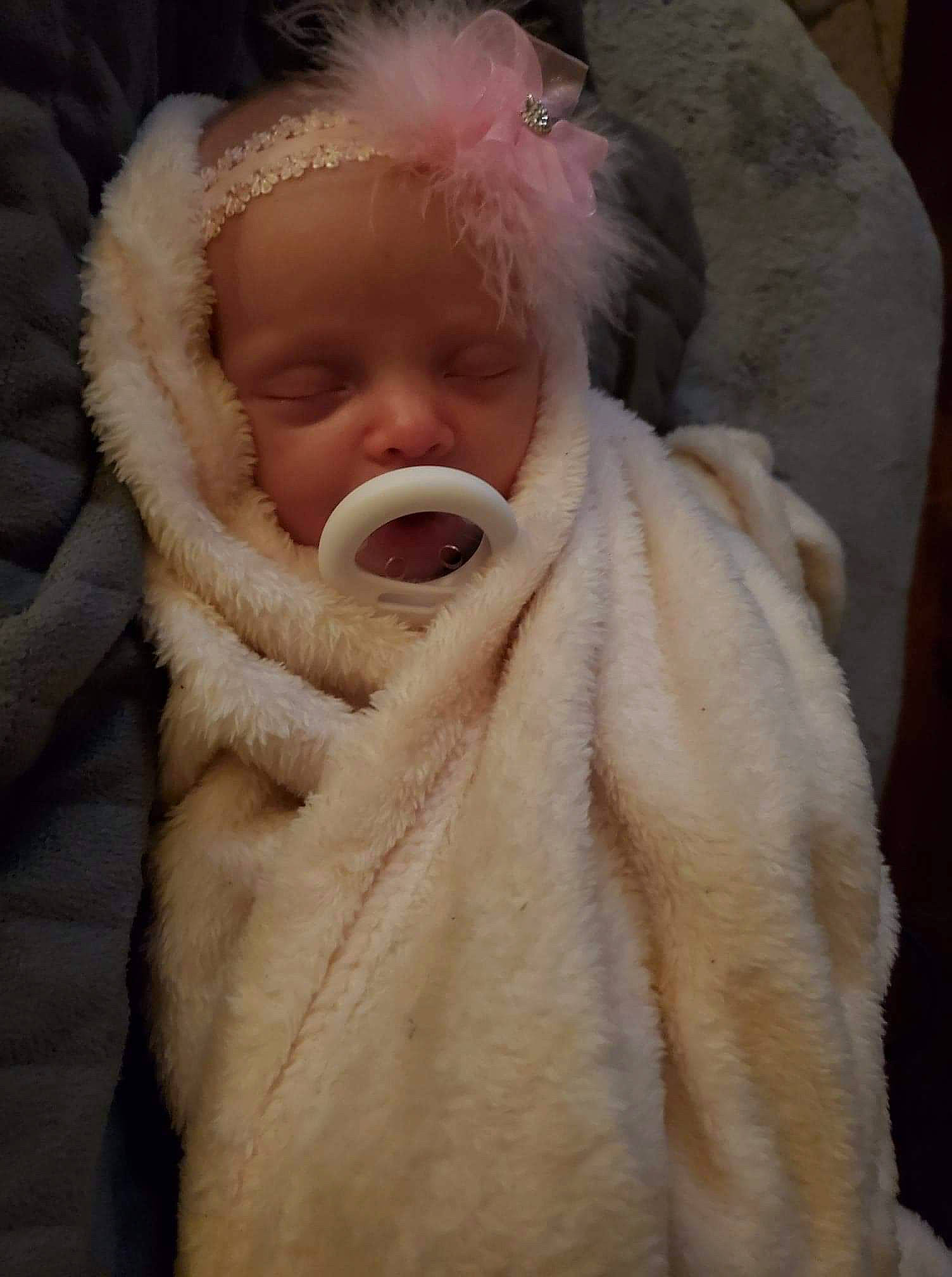 Estelle joined the competition — help win amazing prizes! baby, cheek, child, facial_expression, fur, fur_clothing, head, mouth, nose, person, skin, textile, toddler, wool, yawn