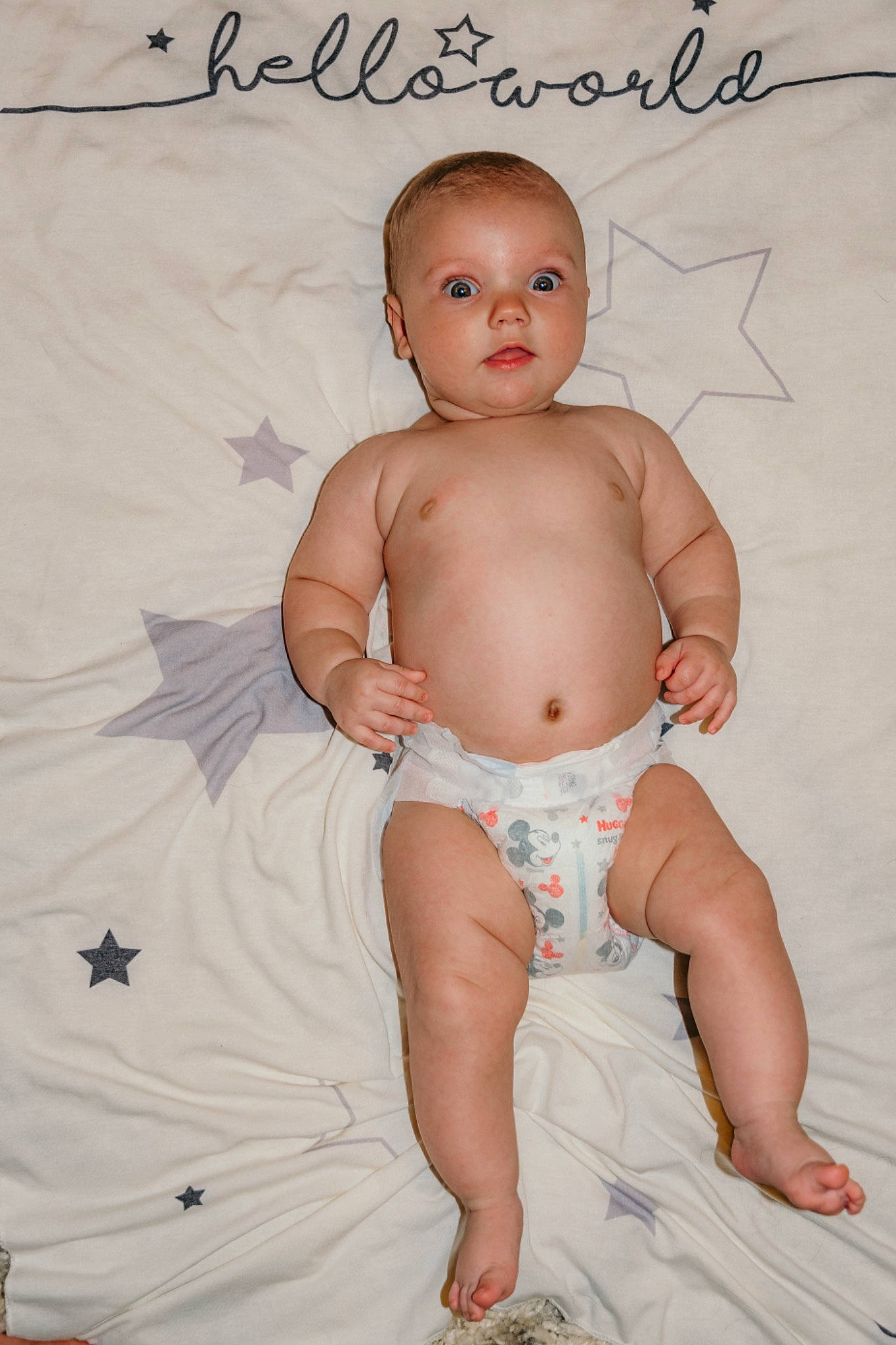 Calihan joined the competition — help win amazing prizes! abdomen, baby, baby_products, baby_toddler_clothing, barefoot, child, diaper, head, leg, muscle, pattern, person, product, sitting, skin, stomach, toddler, trunk