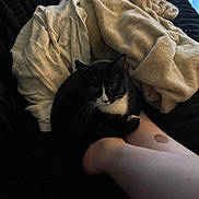 Nova is registered to the contest to win money with this photo: animal, black_and_white, blanket, casual, cat, comfort, couch, cozy, curious, domestic_animal, feline, fur, home, indoor, leg, person, pet, relaxing, resting, soft