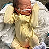 Jakaidens joined the competition — help win amazing prizes! baby, blanket, cute, face, foot, hand, head, hospital, indoors, infant, medical_tape, nasal_tube, newborn, peaceful, person, resting, sleeping, sock, striped_hat, yellow_onesie